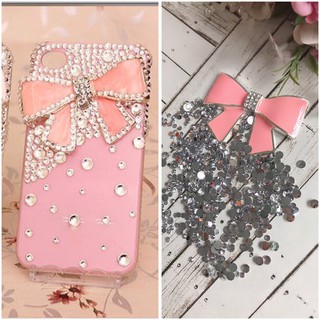Set Trang Trí Ốp Lưng Mẫu NƠ