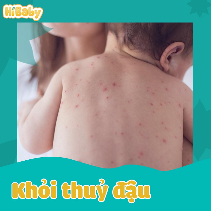 Gel bôi da hỗ trợ kháng khuẩn cho bé Hi Baby - Tuýp 20 gram