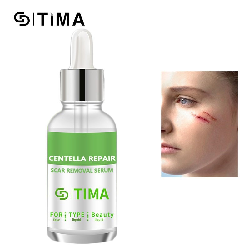 Serum mặt GDTIMA tinh chất cá sấu phục hồi vết sẹo 30ml