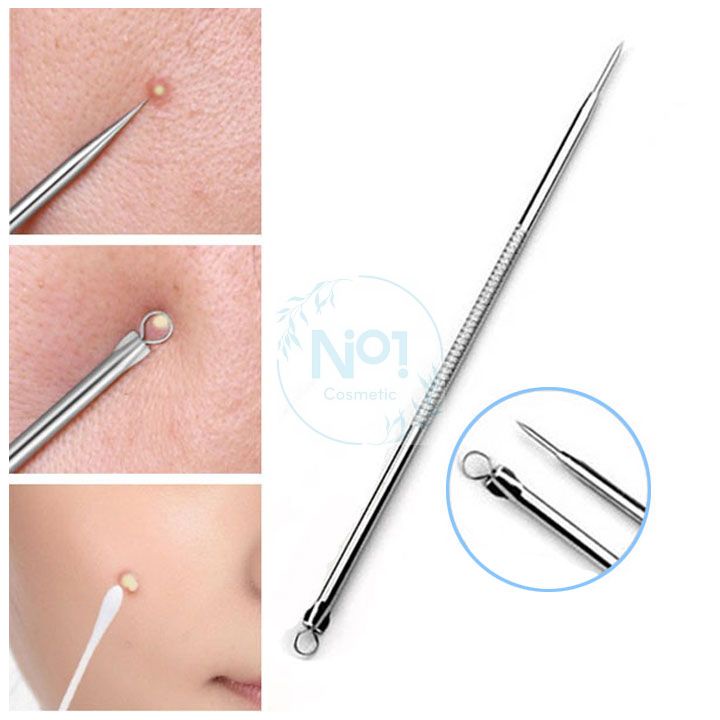 Que Nặn M.ụn Inox 2 đầu