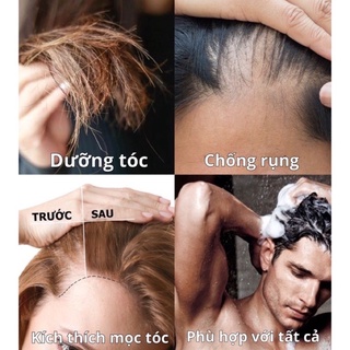 xịt loãng tóc nam