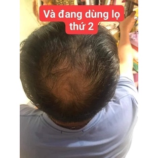 PHỦ BẠC NHANH CHÓNG THÀNH ĐEN LACO 200ML