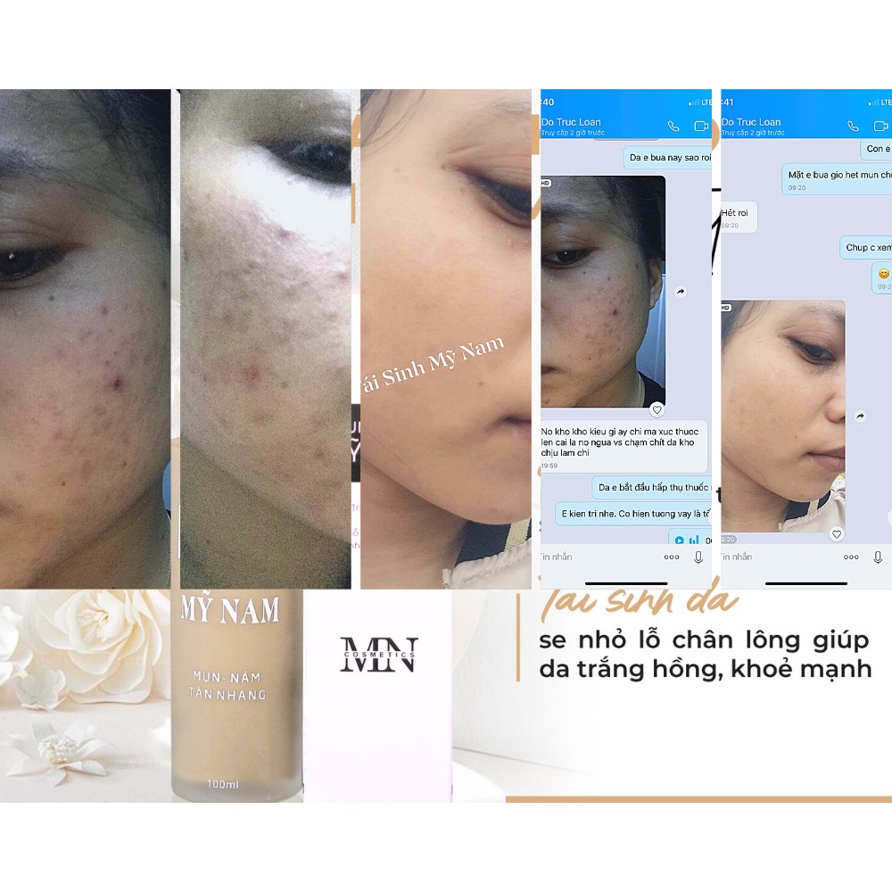 Combo Cải Thiện Mụn Siêu Tốc Mỹ Nam - Cải Thiên Tận Gốc Mụn, Thâm Nám, Tàn Nhang, Sẹo Rỗ