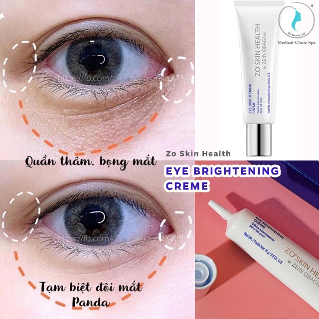 Kem dưỡng sáng da mắt Zo Skin Health Eye Brightening Creme 15g giúp làm sáng da vùng mắt, giảm quầng thâm vết chân chim