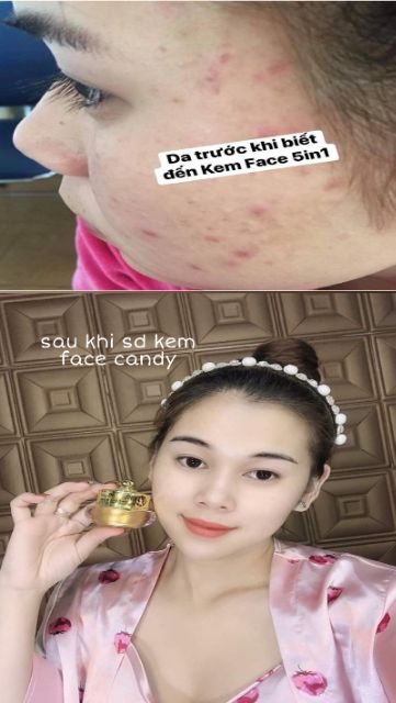 combo 3 Kem face candy  [ tặng kèm quà] | BigBuy360 - bigbuy360.vn