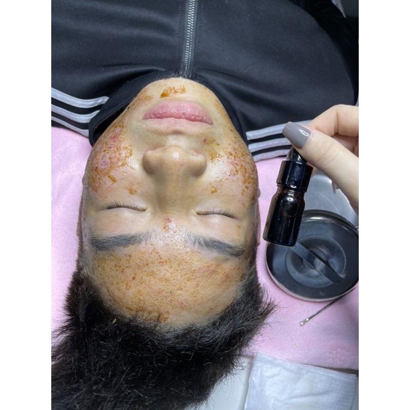 Serum mụn thảo dược LaDy | BigBuy360 - bigbuy360.vn