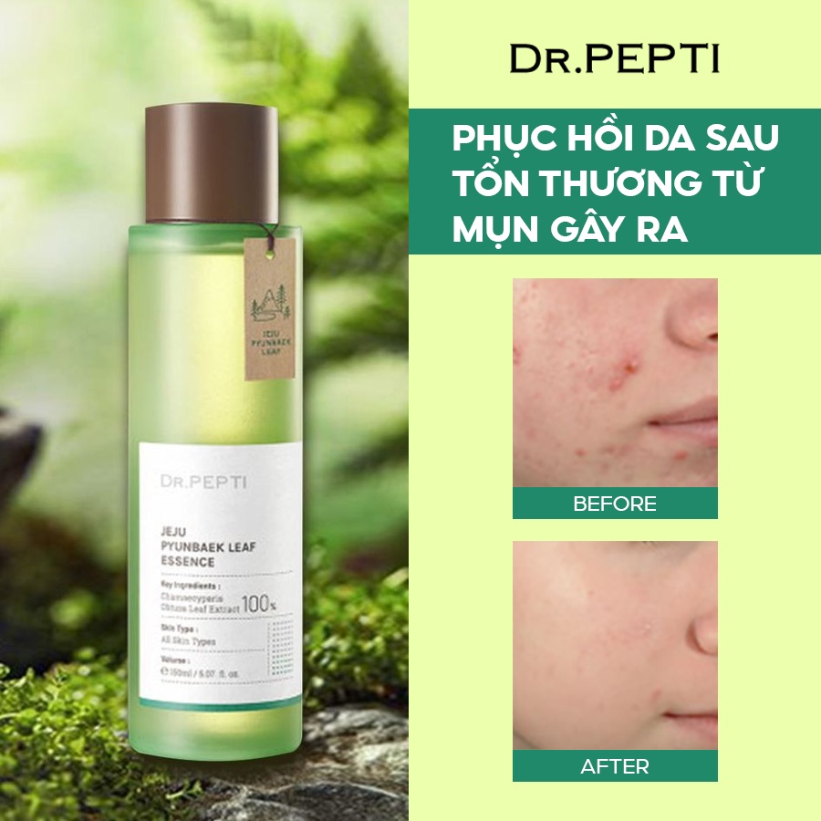 Tinh Chất Phục Hồi Da Chiết Xuất Từ Tinh Dầu Lá Bách Xanh Đảo Dr.pepti Jeju Pyunabek Leaf Essence 150ml