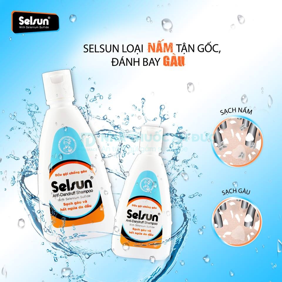 Dầu Gội Selsun Ngừa Gàu & Giảm Ngứa Da Đầu 100ml 1% Selenium Sulfide Anti-Dandruff Shampoo – Nhà thuốc An Đức