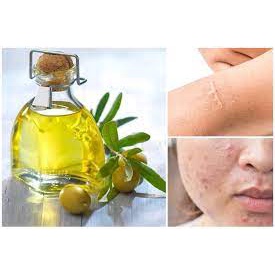 Dầu mù u vàng nguyên chất dung tích 50ml | BigBuy360 - bigbuy360.vn