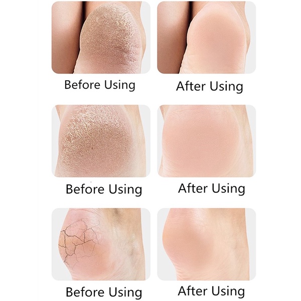 ‍♀️ 2pcs/set Silicon Gel Bảo Vệ Gót Chân Giúp Dưỡng Ẩm Chống Nứt Nẻ