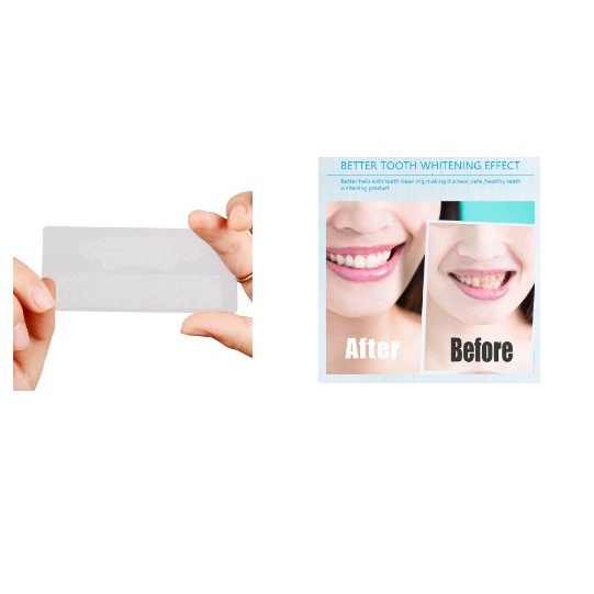 Hộp 7 Miếng dán Trắng răng 5D White Teeth Whitening Stripss