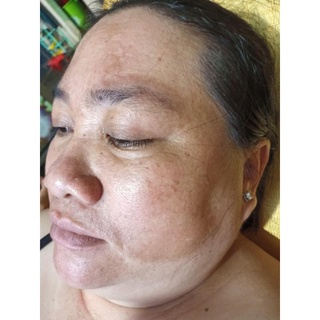 Serum dưỡng da yody white phương anh
