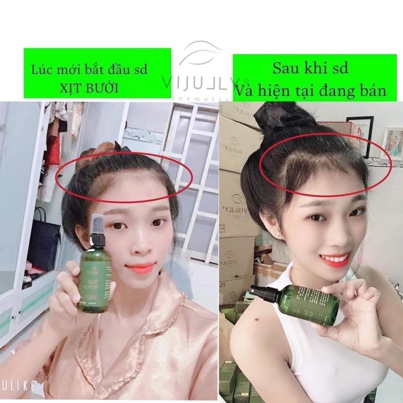 Tinh Dầu Bưởi VIJULLY [Kích Mọc Tóc] 100% Tự Nhiên | BigBuy360 - bigbuy360.vn