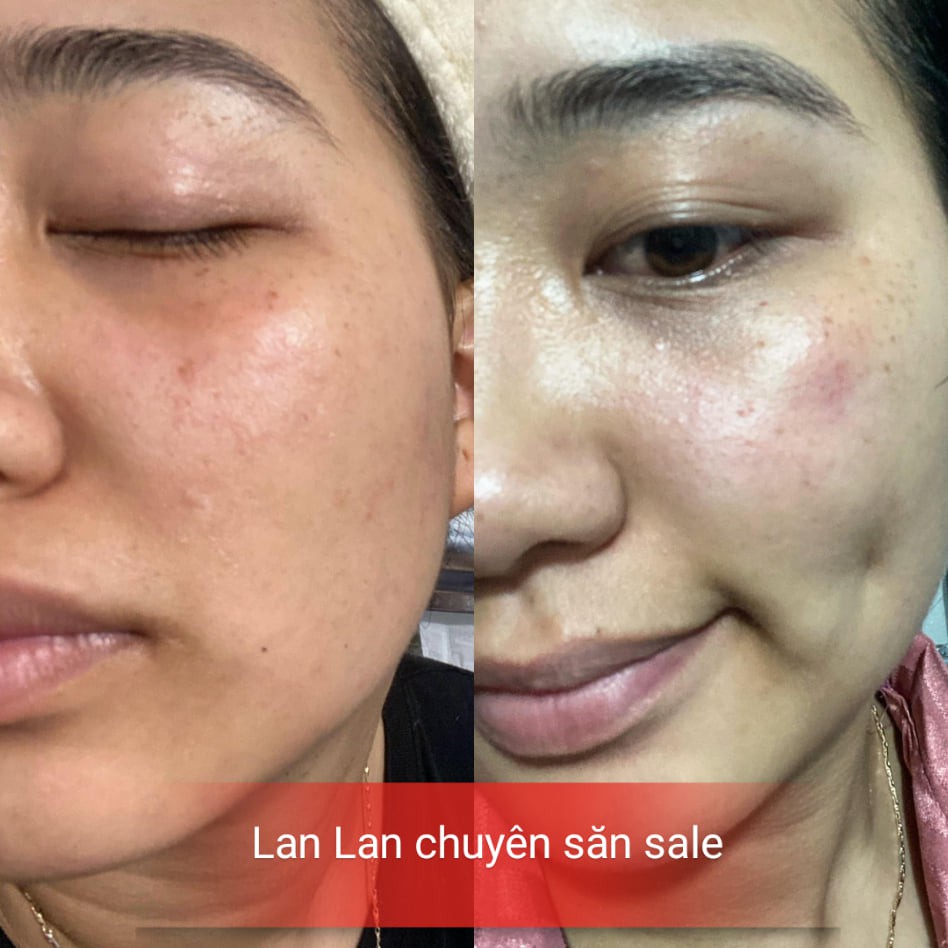 Kem Dưỡng Ban Đêm - Chống Lão Hoá