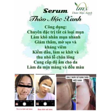 Serum Thảo mộc Xanh