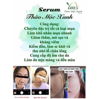 Serum Thảo mộc Xanh [chính hãng]