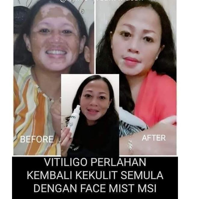 Cổ phiếu trị giá	1 chai tinh chất vàng 100% nguyên bản từ MSI | BigBuy360 - bigbuy360.vn