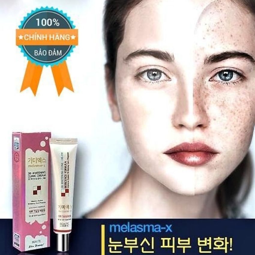 Kem giảm nám tàn nhang Melasma 3D Clinic Cream Hàn Quốc,  dưỡng trắng cải thiện làn da lão hóa