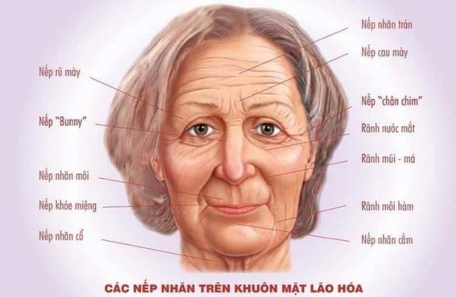 Botox xóa nhăn , chống chảy xệ , trẻ hóa