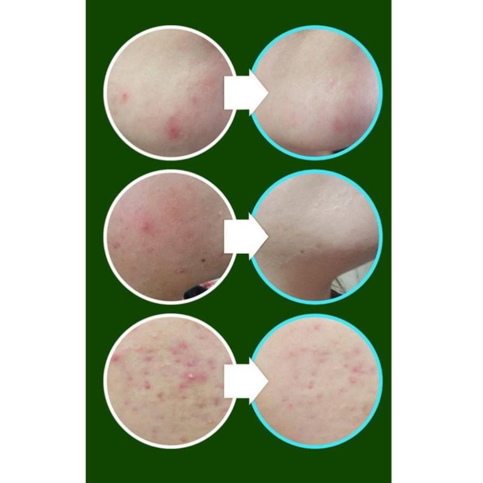 [AUTHENTIC] Tinh Chất Chiết Xuất Rau Má Madagascar Centella 100ml | BigBuy360 - bigbuy360.vn