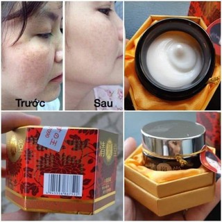 Kem vua nhật bản