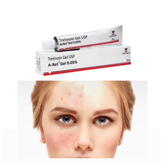 GEL TRẺ HÓA, HỖ TRỢ MỤN NÁM MENARINI TRETINOIN GEL USP 0.05% W/W