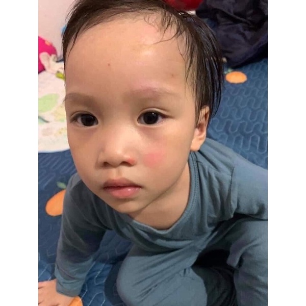 CAO SẸO BẠCH LINH -BÁCH Y SÂM -NHẤT MỘC HƯƠNG | BigBuy360 - bigbuy360.vn