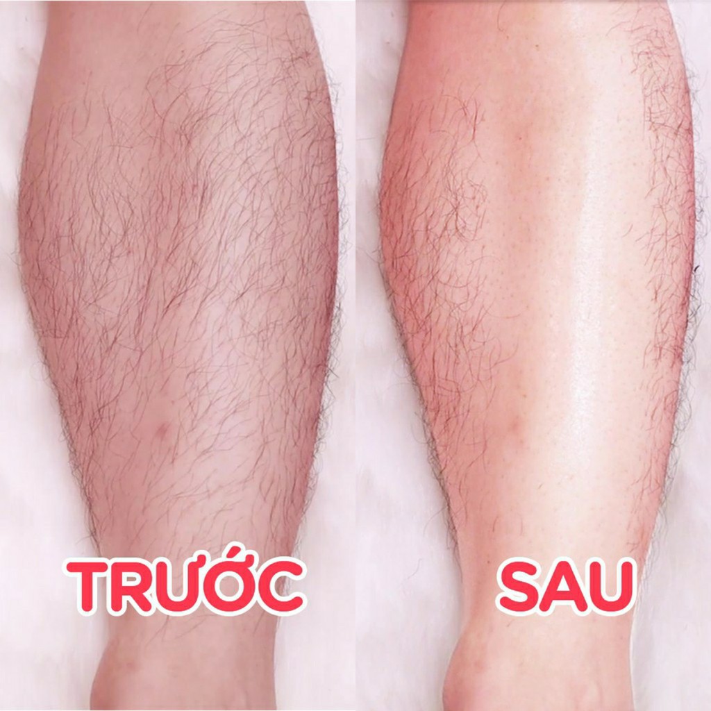 Kem Tẩy Lông Body OvaMin - Triệt Lông Nách, Chân, Tay, Bikini/Vùng Kín An Toàn Không Kích Ứng Da 💖 Chính Hãng | BigBuy360 - bigbuy360.vn