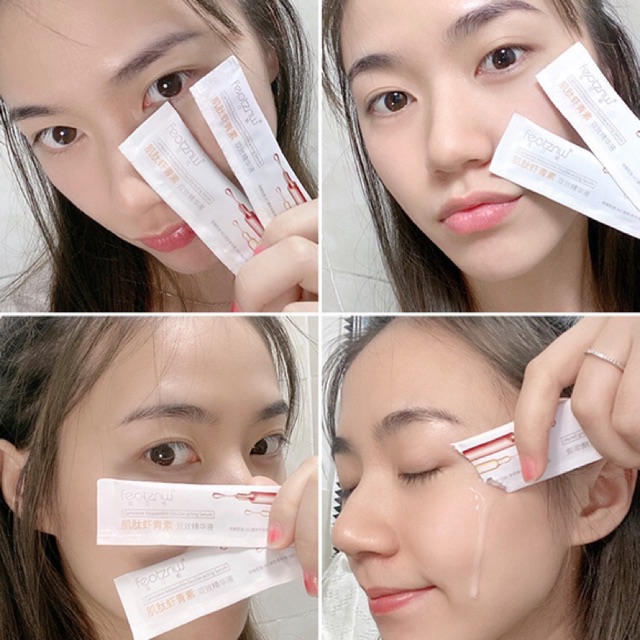 Tinh Chất Feotznw Cứu Tinh cho làn da