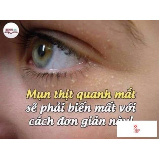 Kem làm mờ mụn thịt Tsubuporon Nhật Bản | BigBuy360 - bigbuy360.vn