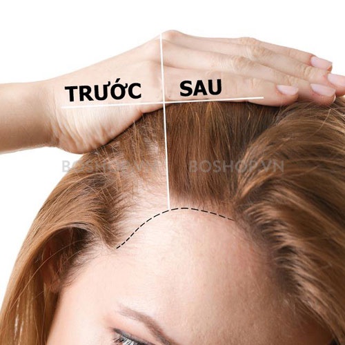 Tinh Chất Thảo Dược Sato Kích Thích Mọc Tóc Nhật Bản 30ml