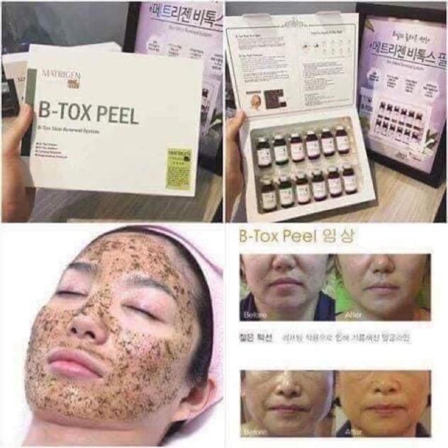 1 hộp btox peel 2 màu dùng trong spa thẫm mỹ viện