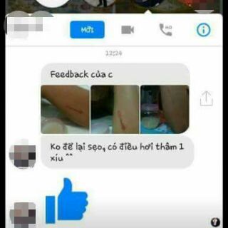Mỡ trăn nguyên chất 100ml.