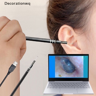 Bút nội soi lấy ráy tai cổng USB chuyên dụng tiện lợi