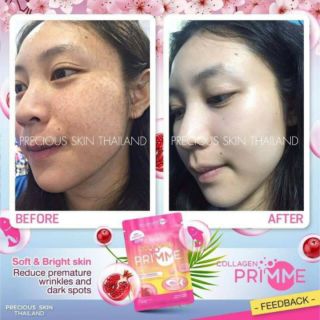 Viên uống Collagen Prime Thái Lan