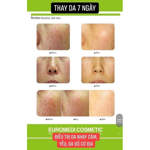Peel Thảo Mộc Zellkur Krauter Peel
