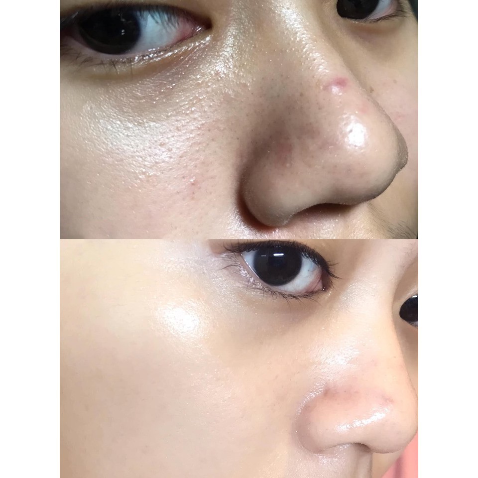 Mặt nạ Sexy Look tràm trà hộp mask 28ml - kiểm soát dầu và mụn sạch lỗ chân lông | BigBuy360 - bigbuy360.vn
