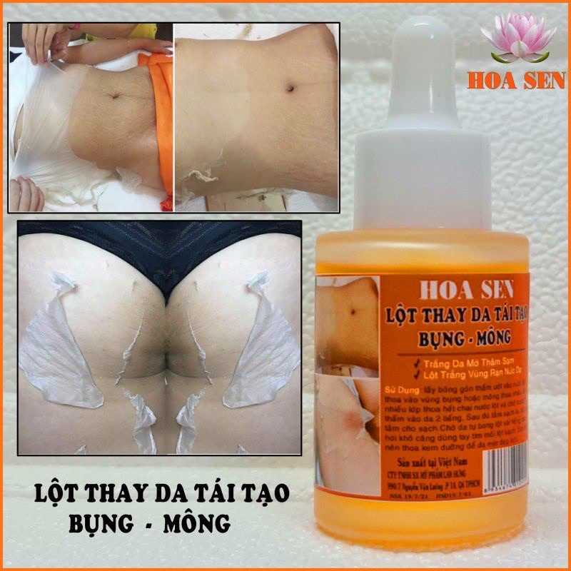 Thay Da Sinh Học Lột Mông Bụng Hết Thâm Rạn Da | BigBuy360 - bigbuy360.vn