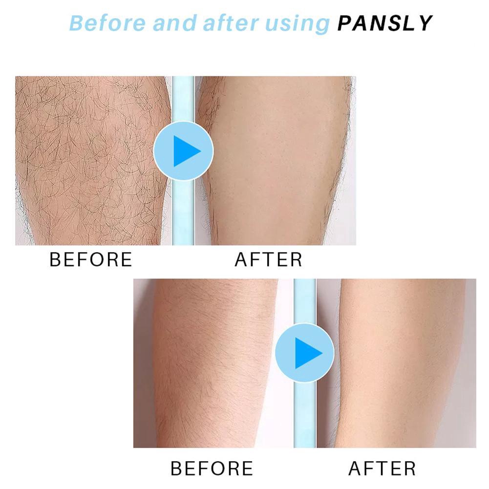 Chai xịt ngăn mọc lông hỗ trợ tẩy lông không đau PANSLY