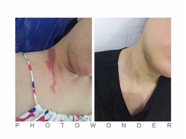 Kem sẹo Gentacin Nhật Bản 10gr