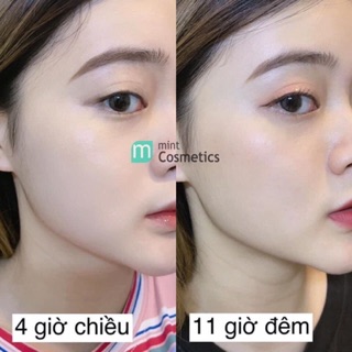Kem nền Mụi Nhật Bản
