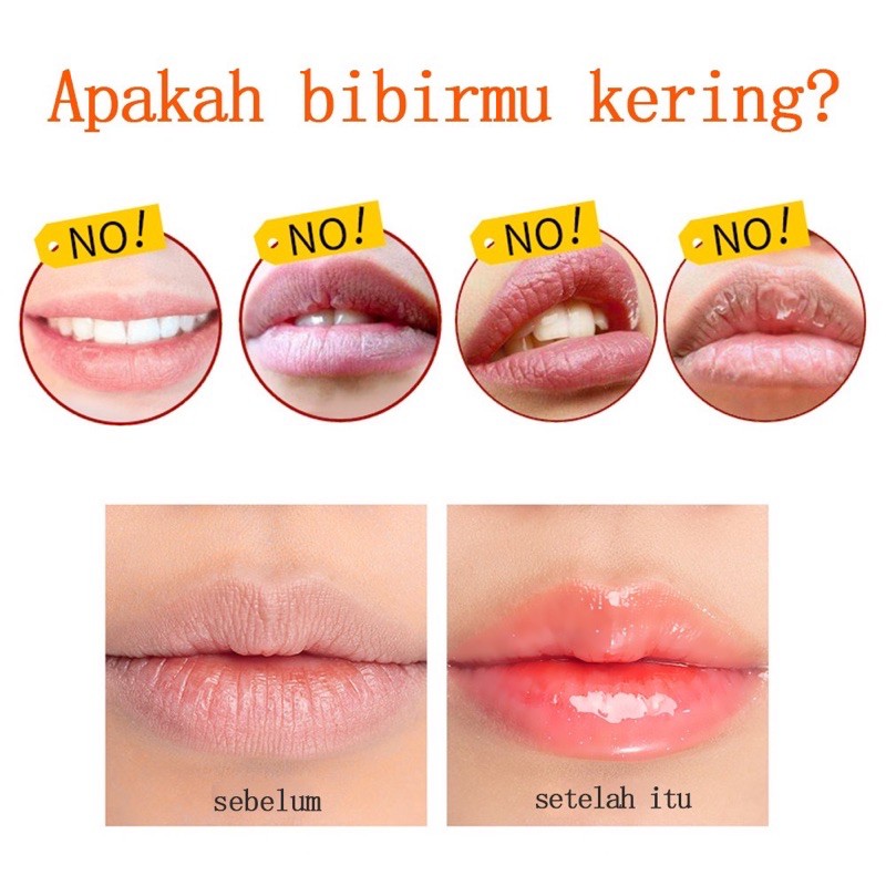 (hàng Mới Về) Set 2 Son Tẩy Tế Bào Chết Cho Môi Yorie / Smooth (min Order 2) | BigBuy360 - bigbuy360.vn