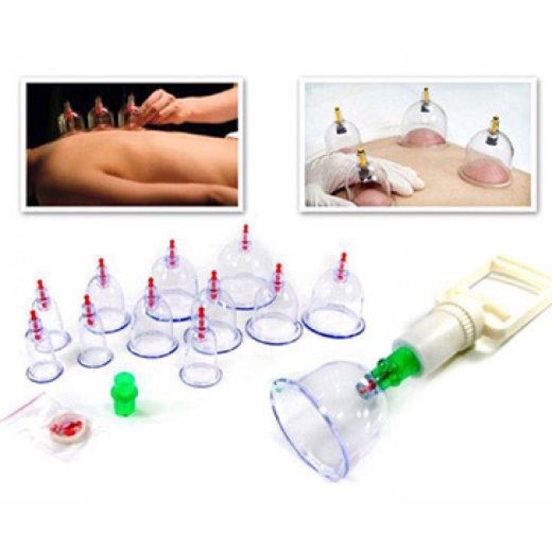 Bộ giác hơi 32 ly, không dùng lửa dùng trong đông y spa tmv