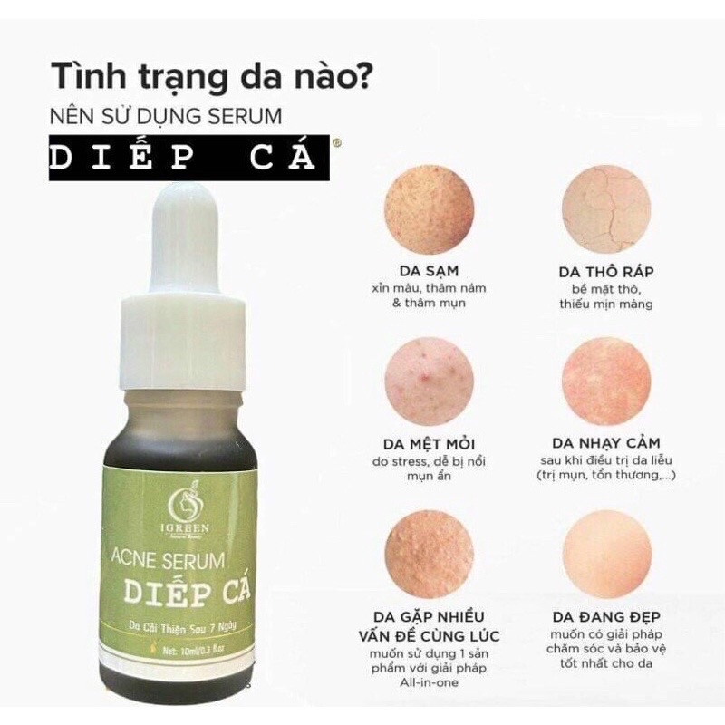 Serum diếp cá Igreen_ Hà Nội | BigBuy360 - bigbuy360.vn