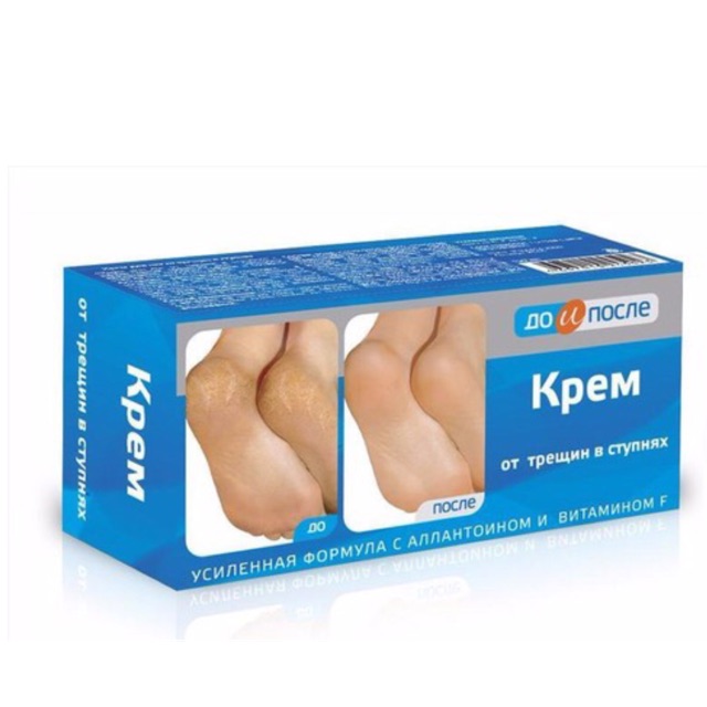 Kem dưỡng ngăn nứt gót chân Kpem 50g