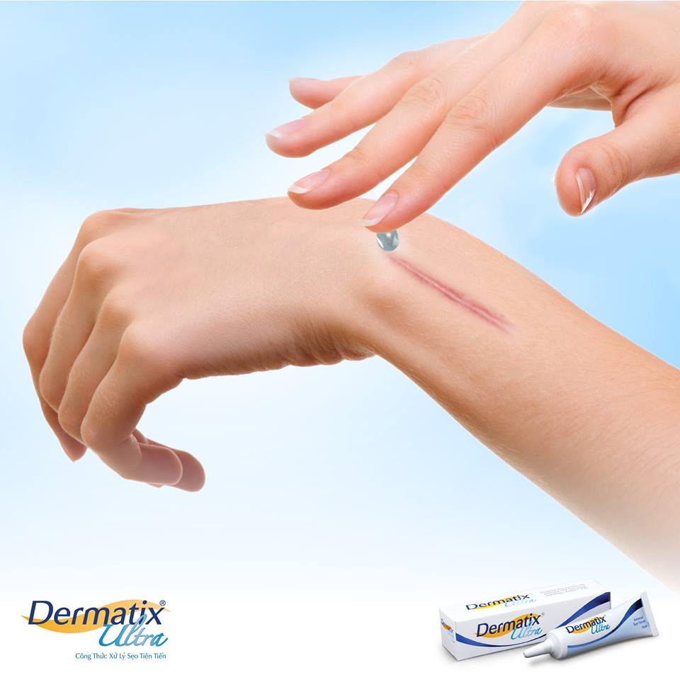✅[Mờ sẹo cấp tốc] Gel hỗ trợ làm mờ sẹo, giảm ngứa Dermatix Ultra