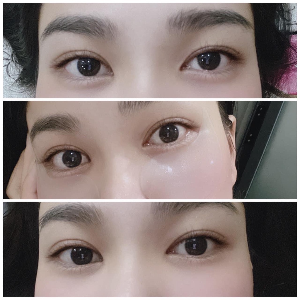 Mặt nạ mắt Weilaiya giảm thâm quầng mắt, nếp nhăn, vết chân chim, vùng da mắt khô ráp. Tặng 2 nạ Weilaiya