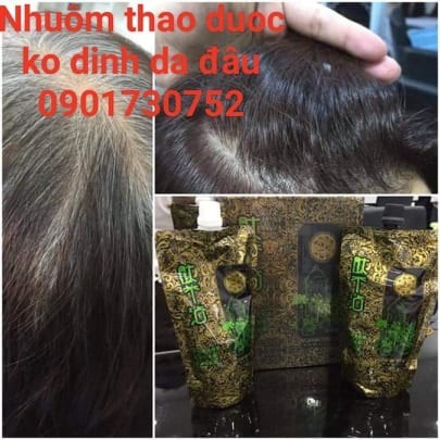 Nhuộm đen thảo dược HD k dính da đẩu cả cặp 500ml x2