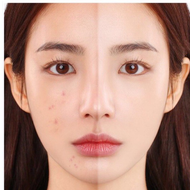 Kem Che Khuyết Điểm Che Mụn Quầng Thâm Tàn Nhang Novo | BigBuy360 - bigbuy360.vn