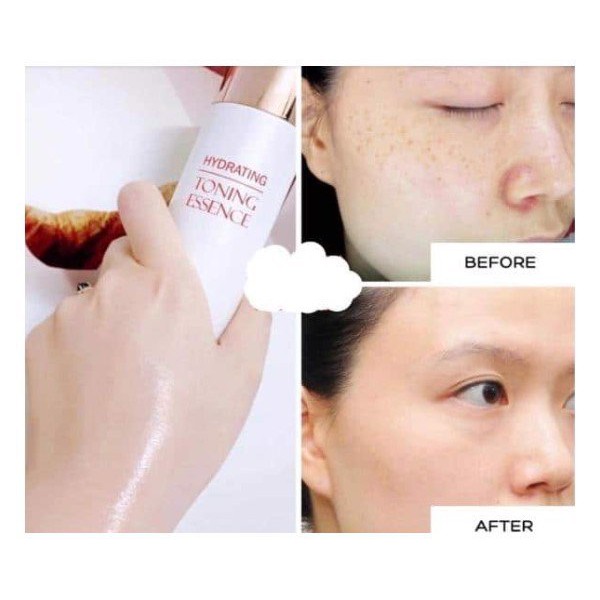 Nước thần tinh chất huyết thanh tơ tằm ( HYDRATING TONING ESSENCE )